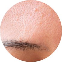 Forehead