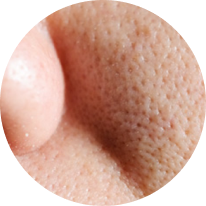 Nose