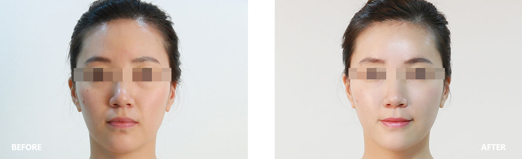 dry-result-banner-1