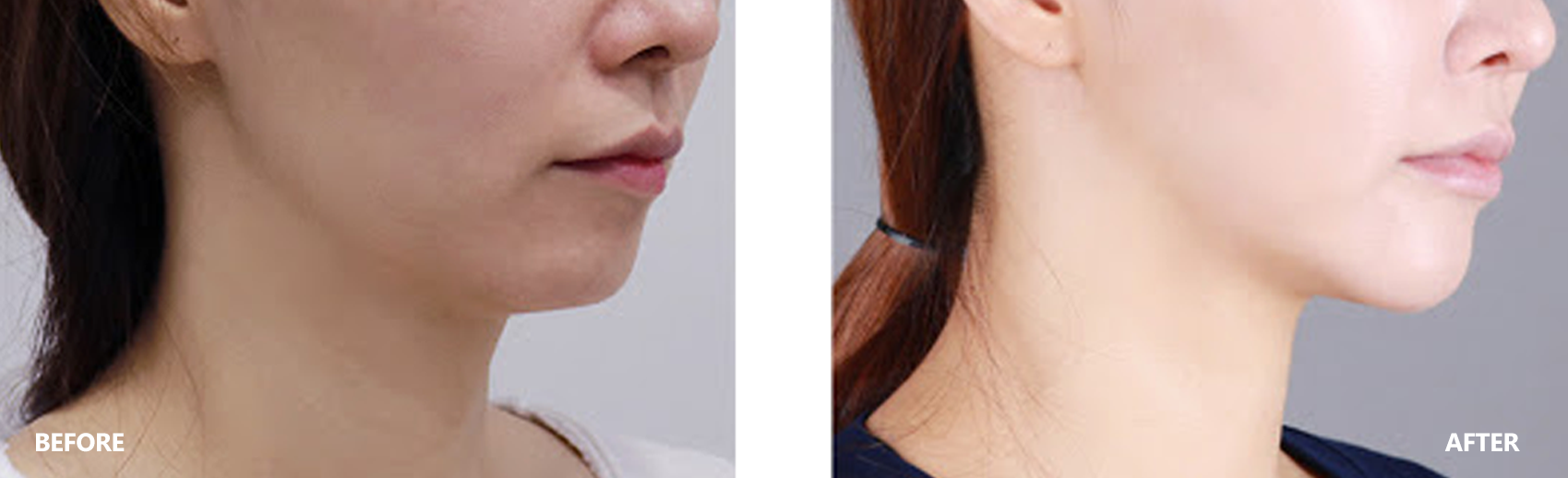 dry-result-banner-2