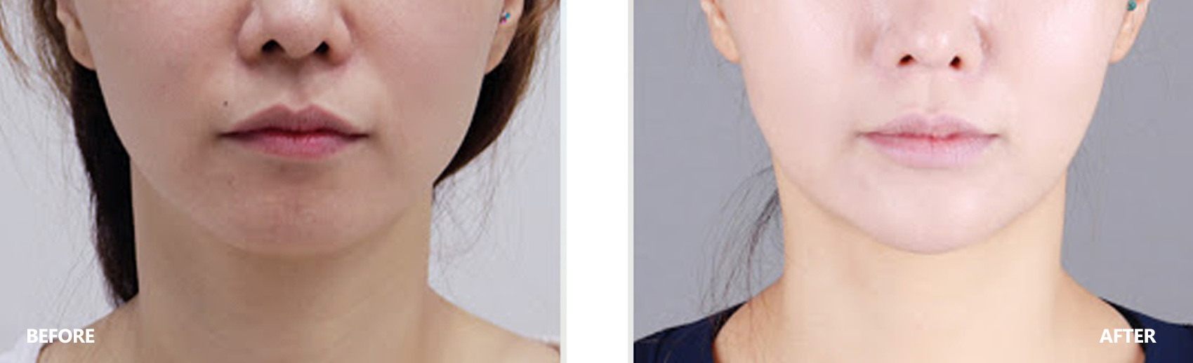 dry-result-banner-3