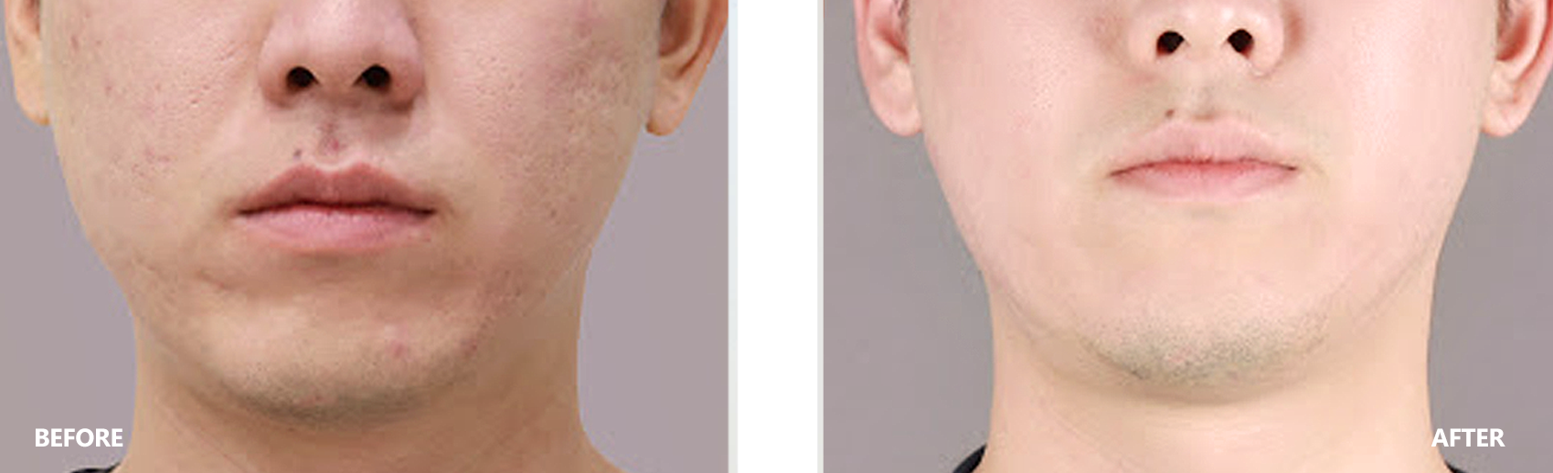 dry-result-banner-4