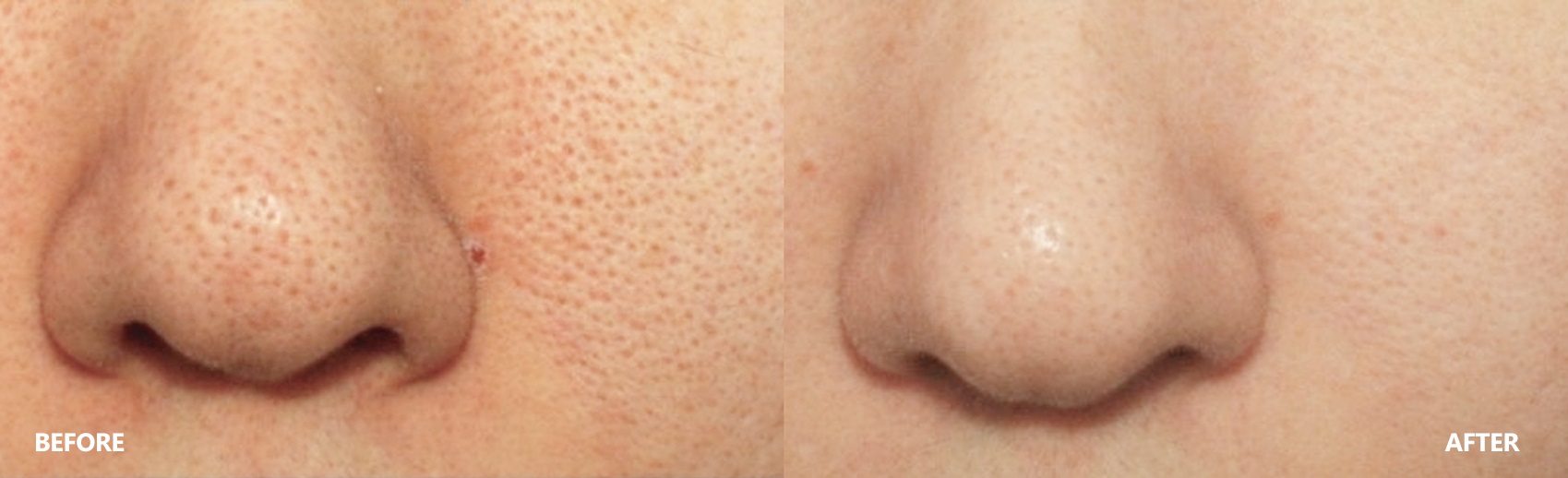 pore-result-banner-2