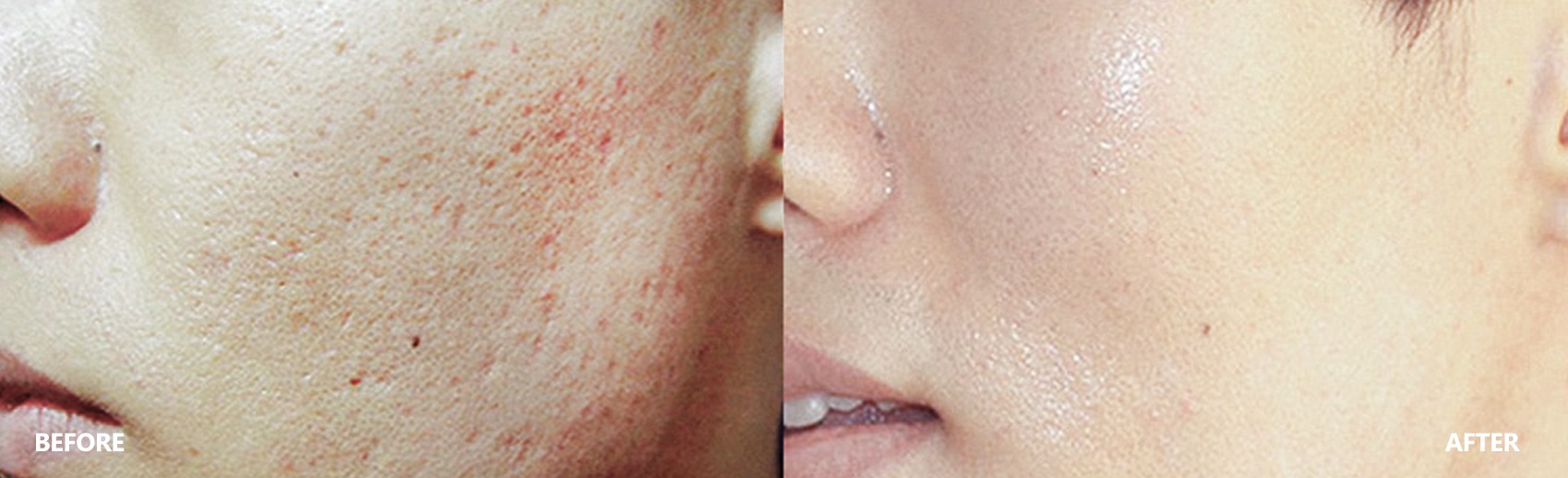 pore-result-banner-3