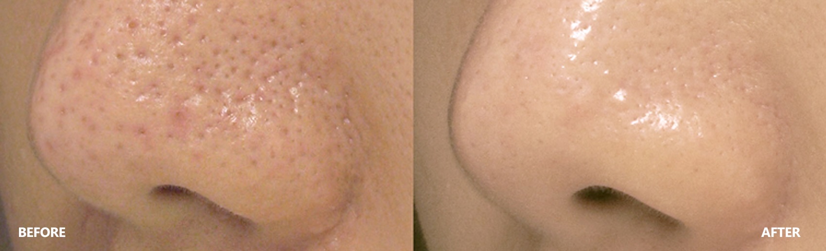 pore-result-banner-4
