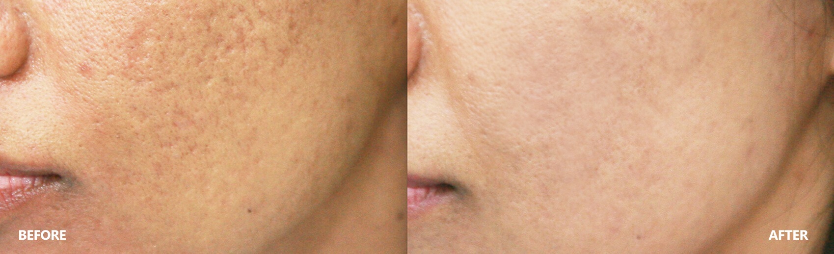 scar-result-1