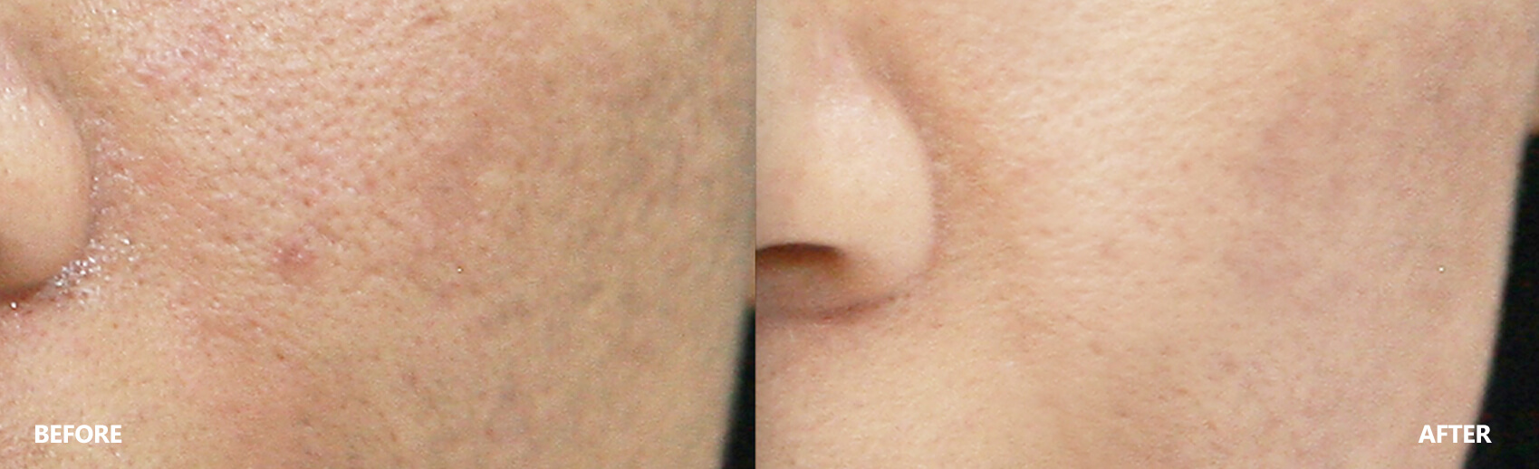 scar-result-2