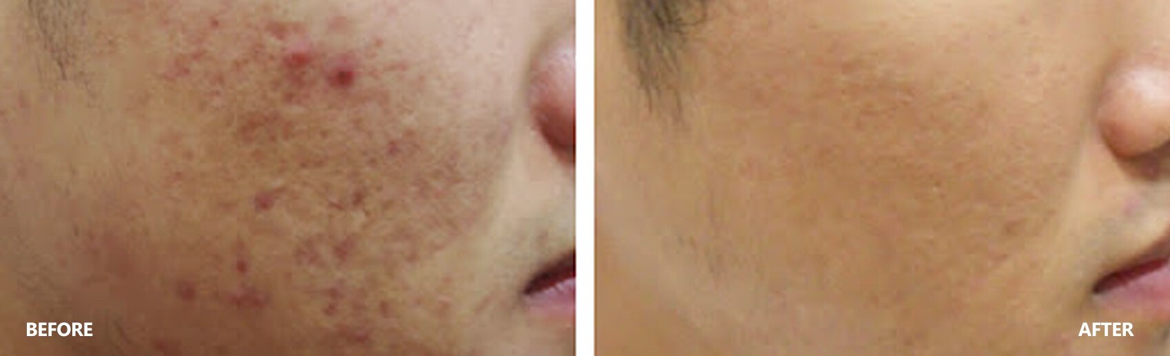 scar-result-3