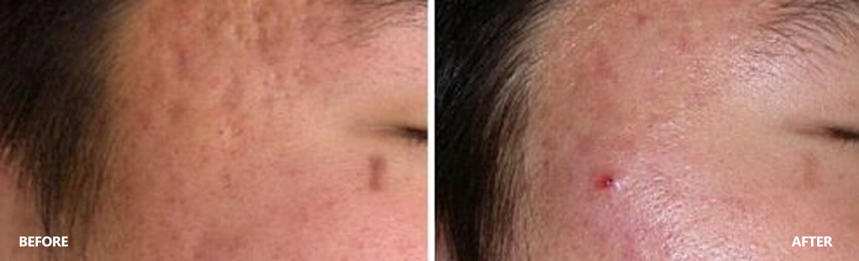 scar-result-4