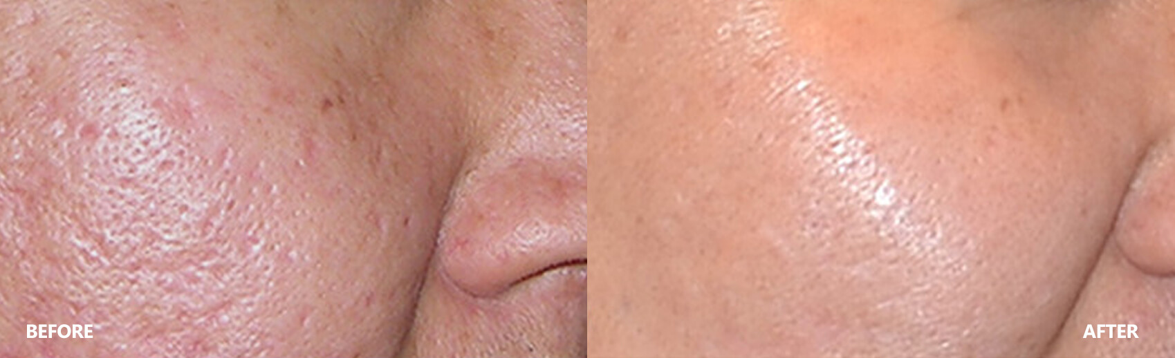 scar-result-5