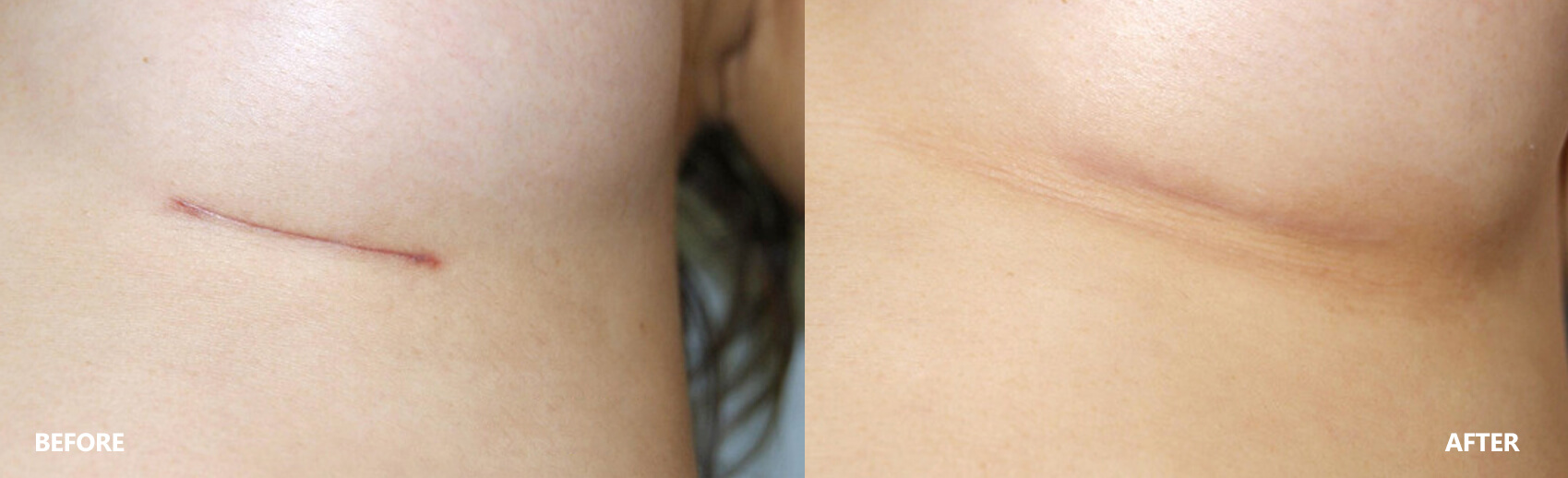 scar-result-7