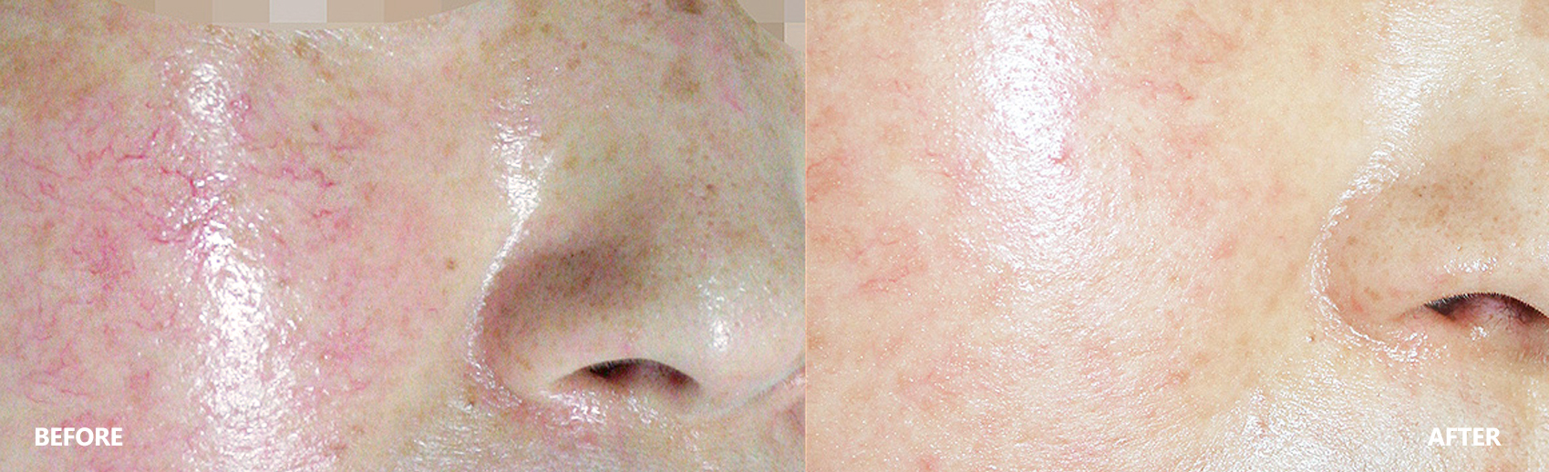 skin-result-1