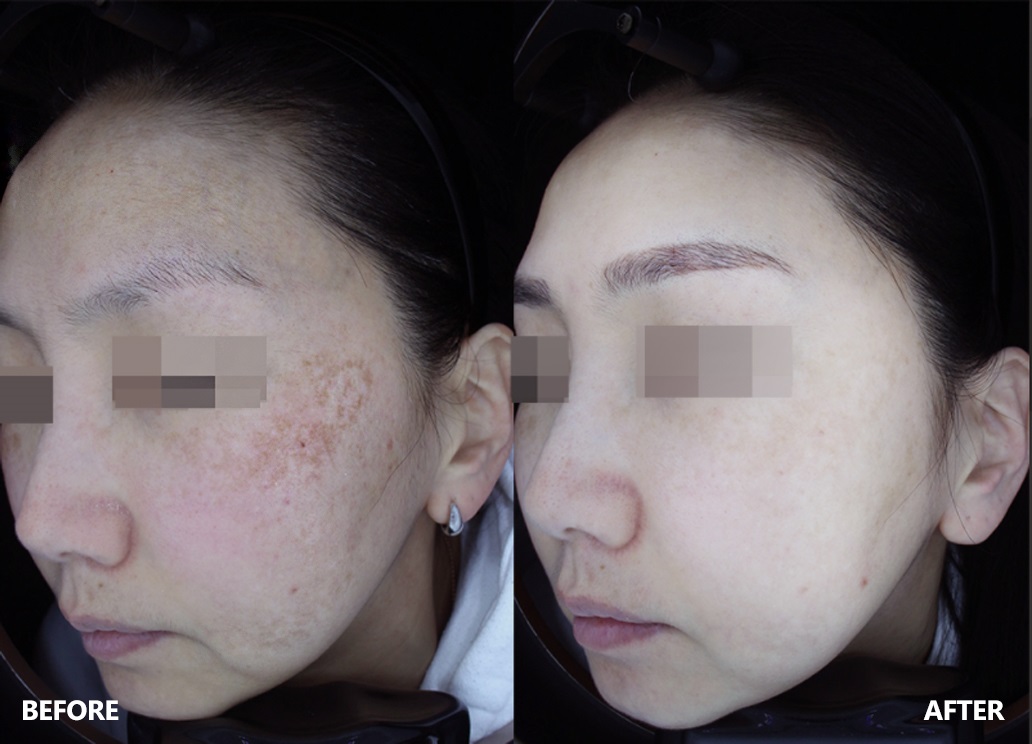 skin-result-1