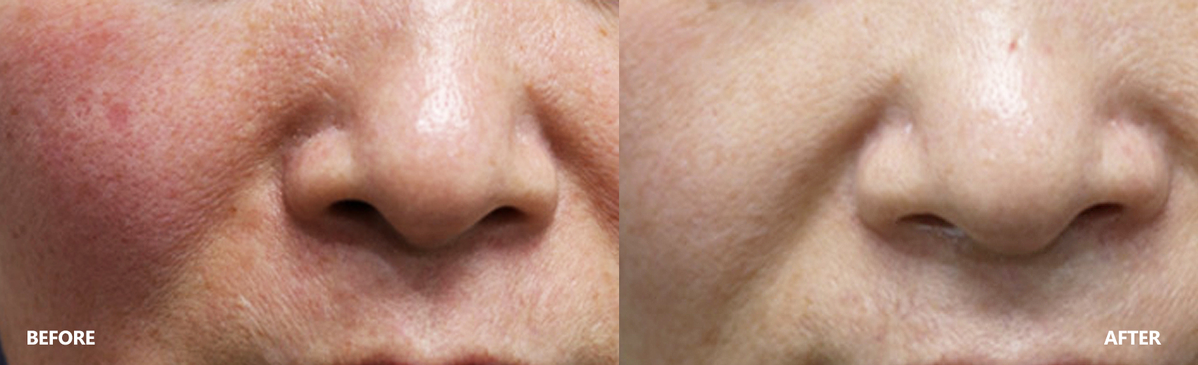 skin-result-2