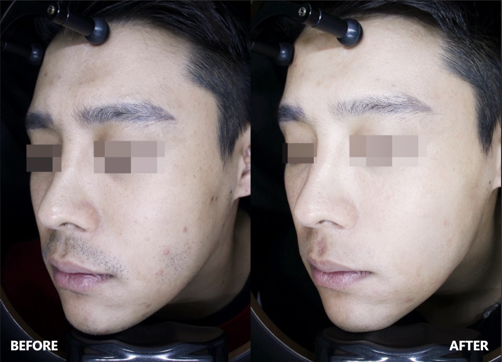 skin-result-2