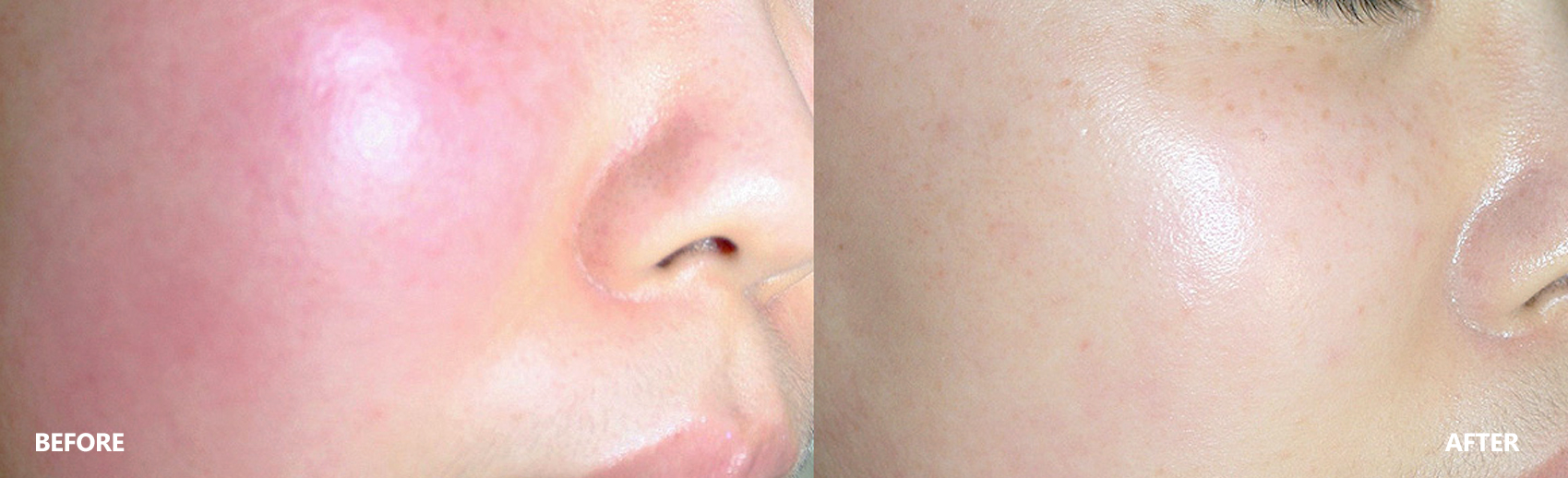 skin-result-3