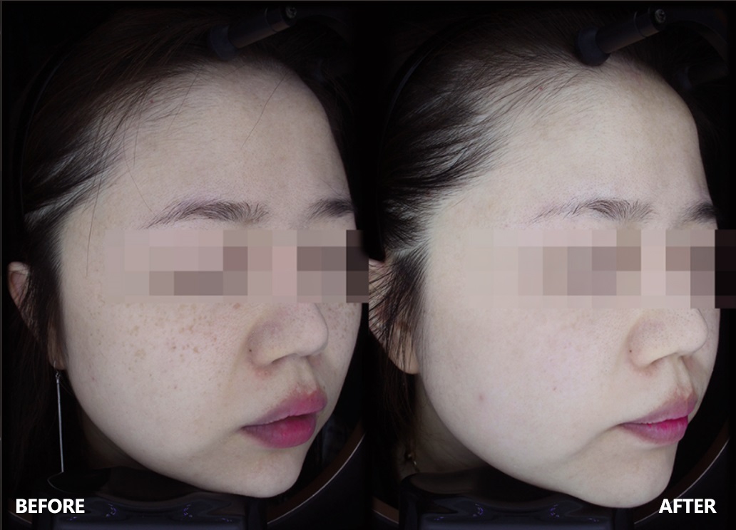 skin-result-3