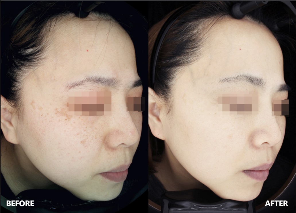 skin-result-6