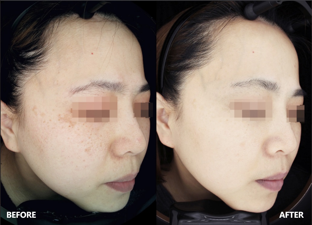 skin-result-6-1.jpg